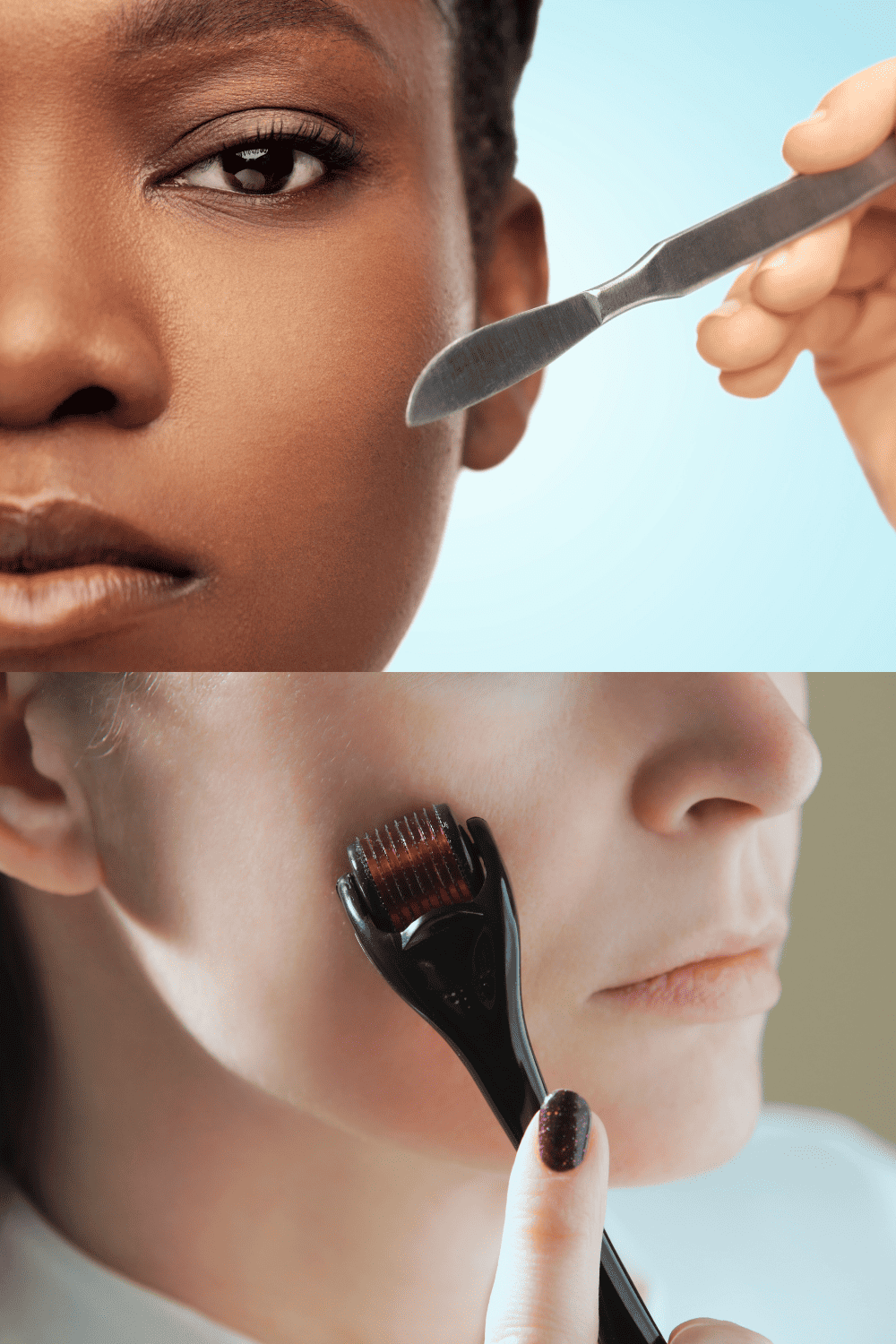 dermaplaning and microneedling
